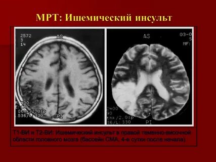 Онмк бассейны
