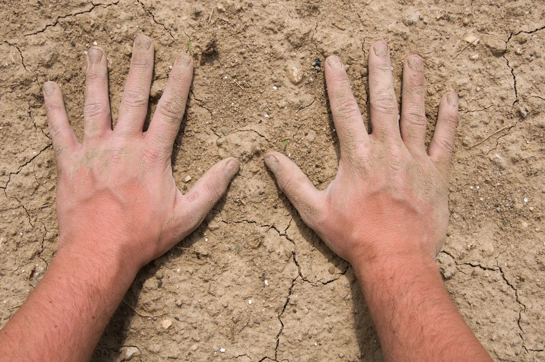 сухость пальцев