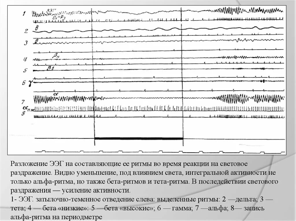 Реакция ээг. ЭЭГ световое раздражение. Реакция ЭЭГ на раздражение. Синхронизация десинхронизация ЭЭГ. Десинхронизация Альфа ритма.