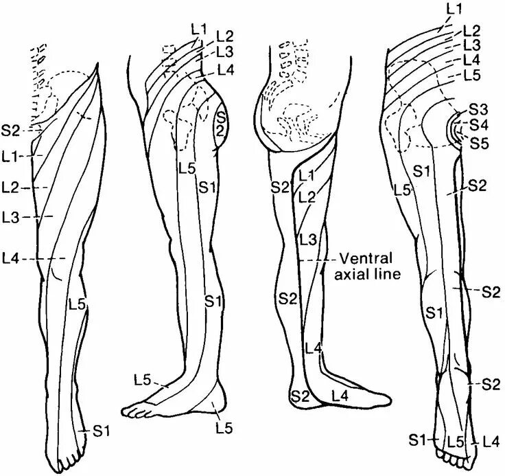 Иннервация нижней конечности схема. Иннервация l4-l5. Корешок l4 иннервация. Корешковая иннервация нижних конечностей схема. Запястье голень и позвоночник