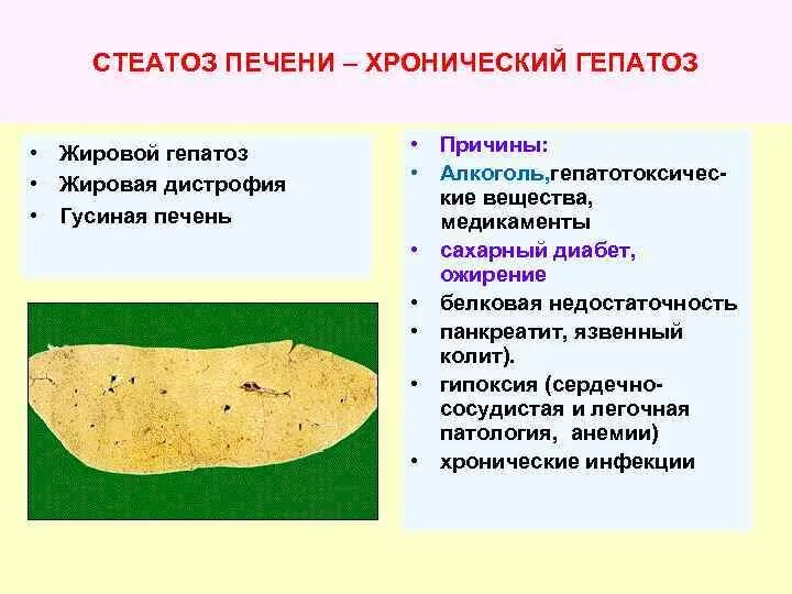 Причины жирового гепатоза печени лечение. Стеатоз печени патанатомия. Жировая дистрофия печени (стеатоз печени). Стеатоз печени 3 степени.