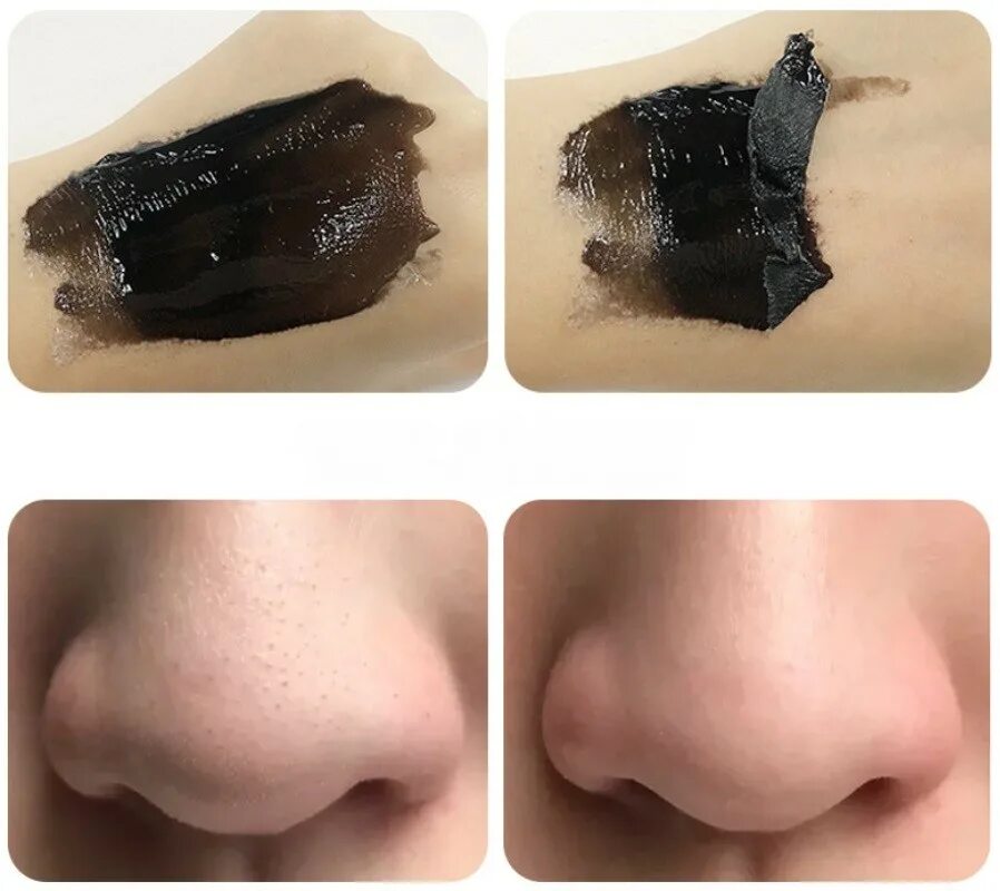 Маска пленка Salicylic acid Blackhead. Маска пленка для глубокого очищения пор на жирной коже. Сальные пробки черная маска. Маска для носа Salicylic acid Blackhead Zoo son.