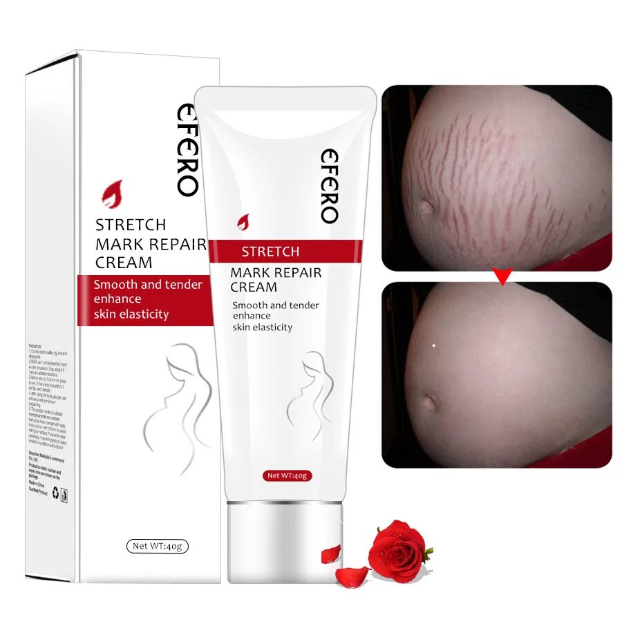 Stretch mark cream. Крем для беременных. Крем против растяжек для беременных. Крем для растяжек.