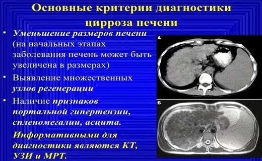 Узлы регенерации. Узлы регенерации