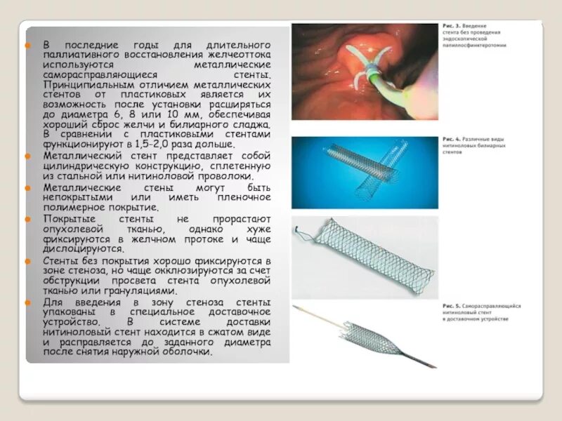 Нитиноловый стент для желчных протоков. Металлический стент для желчных протоков. Пластиковые стенты для холедоха. Стенты покрытые и непокрытые. Стент желчного протока