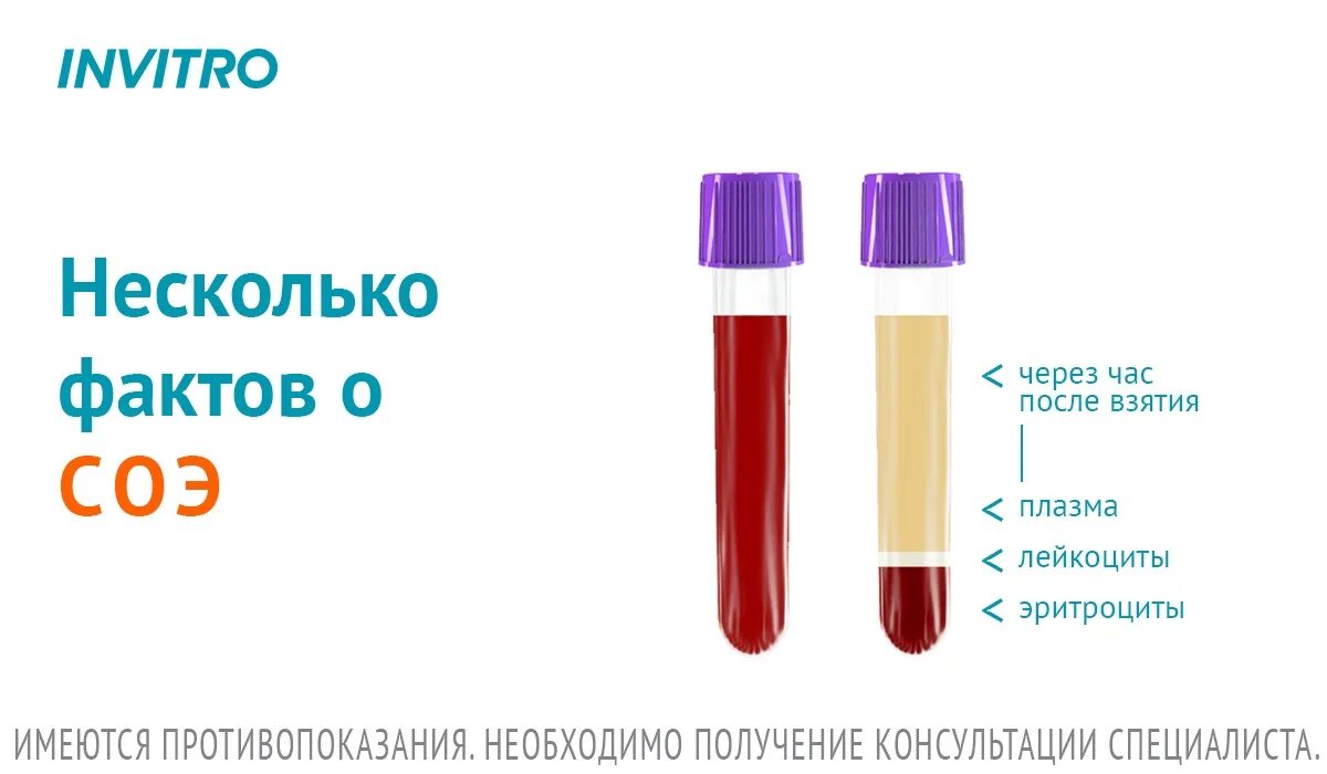 Соэ цена. СОЭ. Скорость оседания эритроцитов. Скорость оседания эритроцитов (СОЭ). Скорость оседания эритроц.