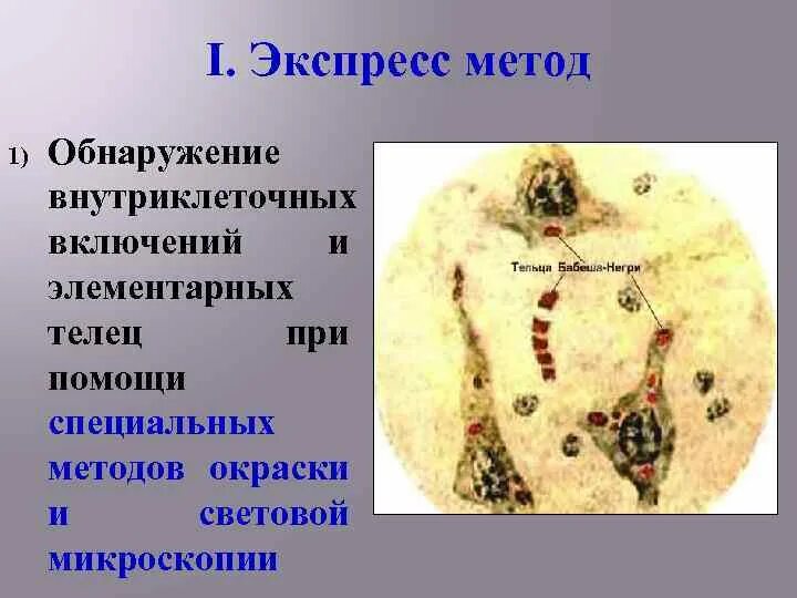 Секреторные включения гистология. Тельца включения при оспе. Микроскопическое исследование патологической анатомии. Методы индикации вирусов в культуре клеток. Тельца включения при оспе.