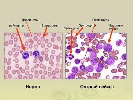 Лейкоциты в костном мозге