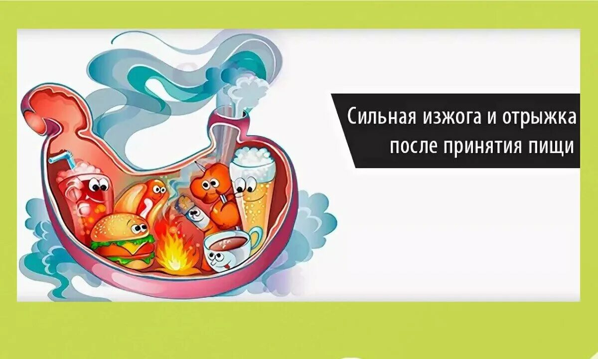 Сильная изжога после. Изжога после еды. Факторы возникновения изжоги.