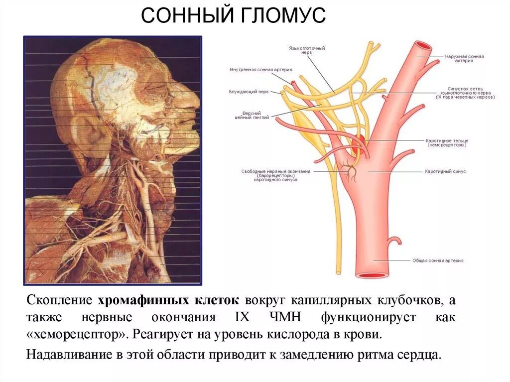 Где находится сонная артерия у мужчин. Гломус каротикум. Сонный гломус анатомия. Анатомия каротидных артерий.