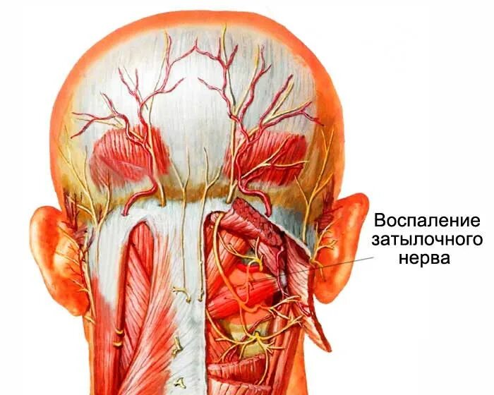 Невралгия затылочного нерва симптомы. Большой затылочный нерв анатомия. Подзатылочный нерв анатомия. Невралгия затылочного нерва нерва.