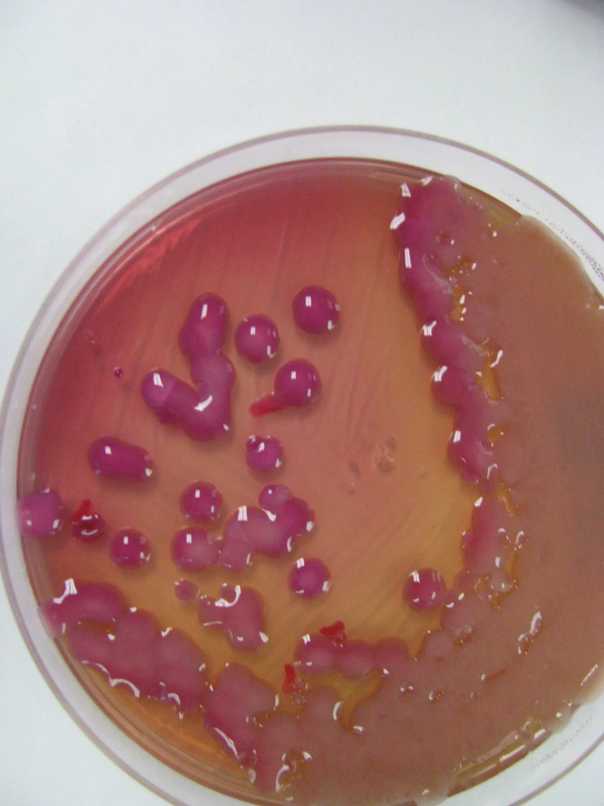 Клебсиелла в год. Клебсиелла окситока. клебсиелла плантикола. klebsiella oxytoca (клебсиелла окситока).