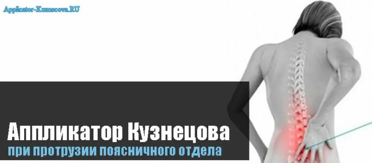 Аппликатор Ляпко протрузия. Ляпко аппликатор для позвоночника. Аппликатор Кузнецова на поясничный отдел. Аппликатор при остеохондрозе поясничного отдела. Аппликатор при болях в пояснице