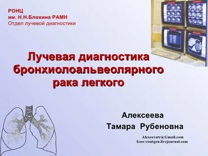 Лучевая диагностика реферат