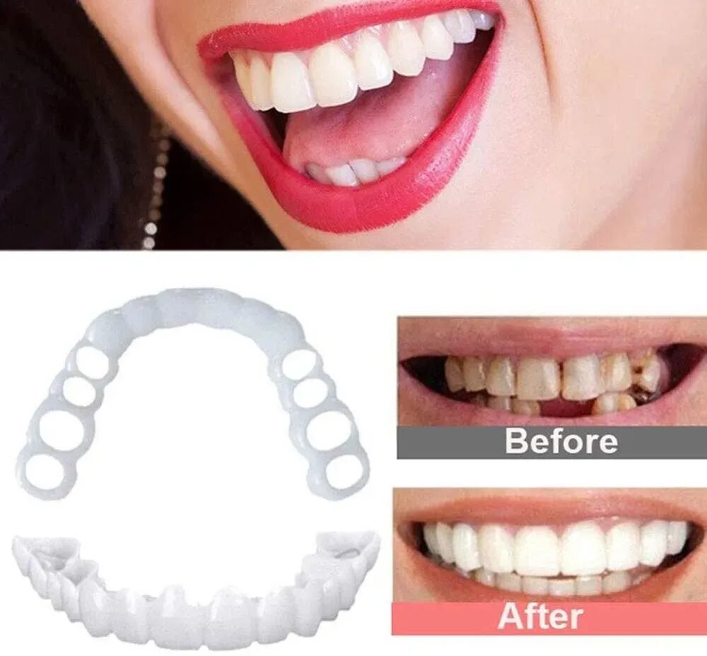 Виниры комплект Snap-on smile. Накладные зубы Snap on smile. Виниры для зубов snapon smile. Виниры для зубов snapon smile (белый).