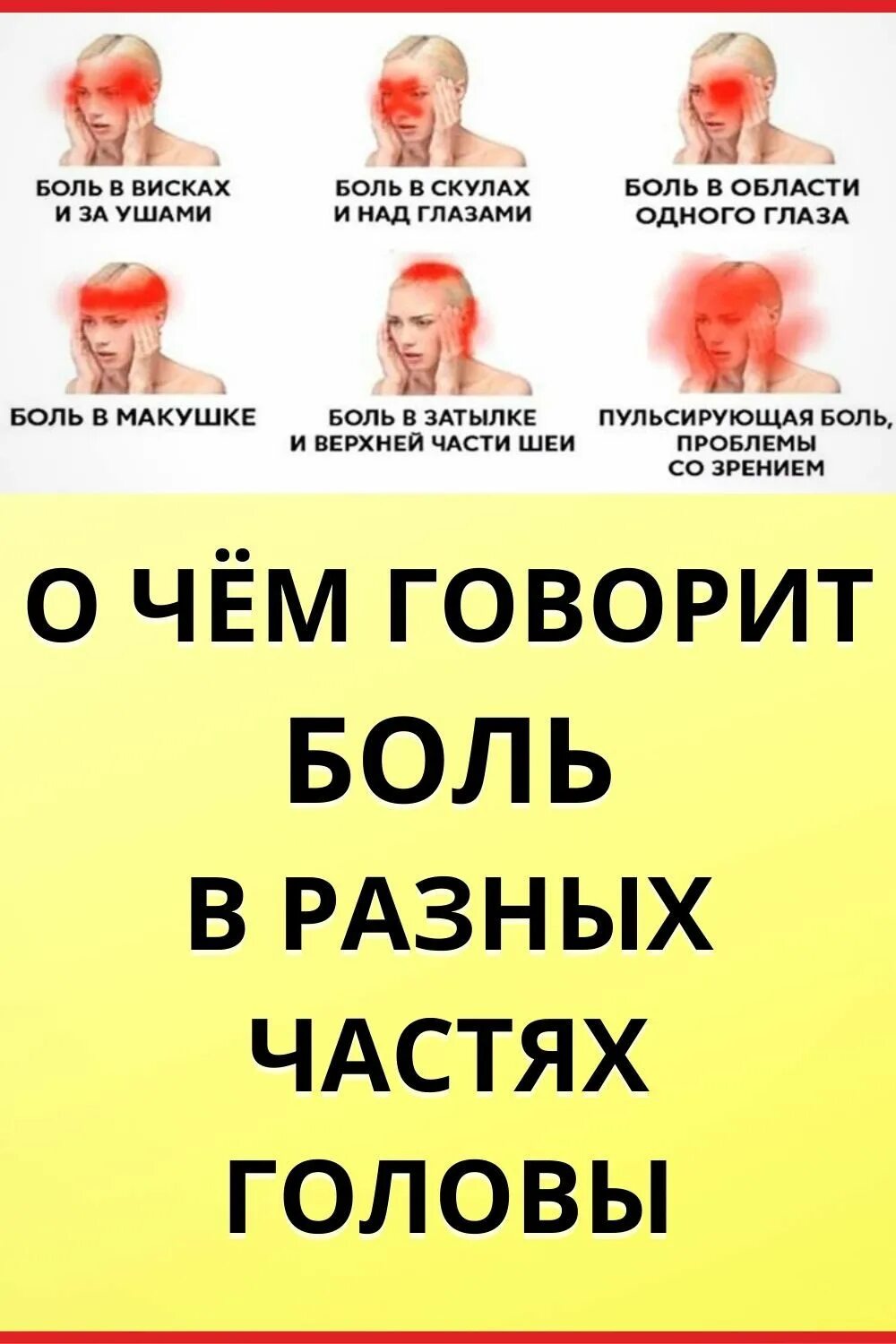 Сильно давит в висках. Головная боль в затылочной части. Болит голова в затылочной части. Типы головной боли. Боль в висках.