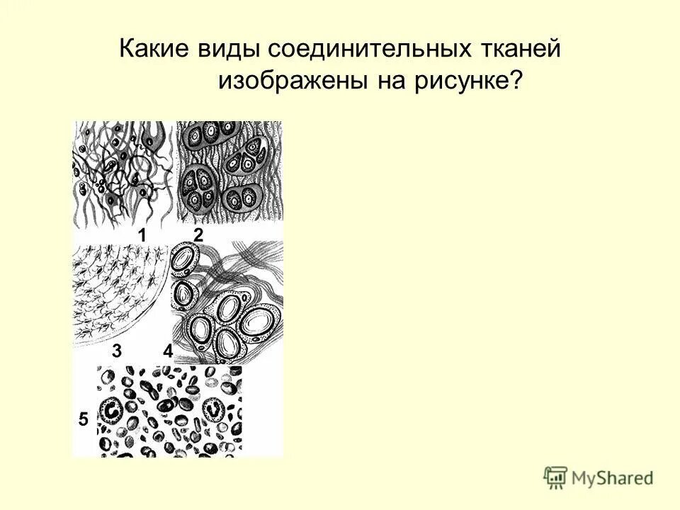 Соединительная ткань какие. Соединительная ткань схематический рисунок. Соединительная ткань строение рисунок. Соединительная ткань растений рисунок. Виды соединительной ткани рисунок.