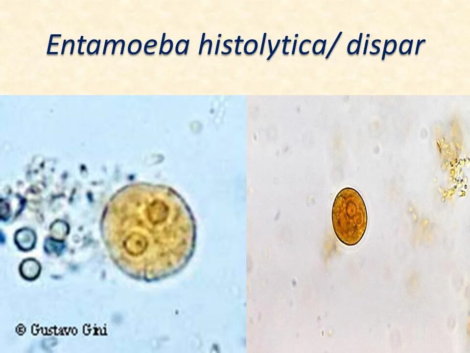 Entamoeba histolytica циста. Цисты Entamoeba. Entamoeba coli циста. Entamoeba histolytica под микроскопом. Entamoeba coli в кале