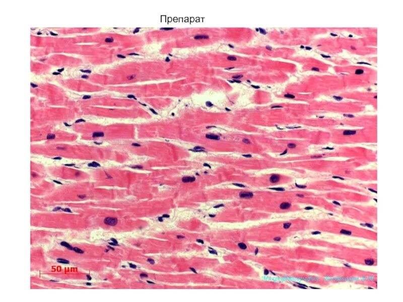 Поперечнополосатая мышца гистология. Гладкая мышечная ткань гистология. Препарат 3 гистология мышечная ткань. Поперечно полосатая мышечная ткань гистология. Препарат поперечно полосатая мышечная ткань