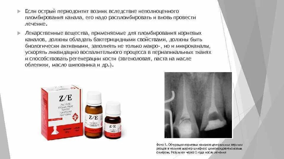 Временное пломбирование корневых каналов. Временное пломбирование корневых каналов при периодонтите. Лекарственные вещества для пломбирования каналов. Материал для временного пломбирования каналов временных зубов. Лечебные препараты для периодонтита.