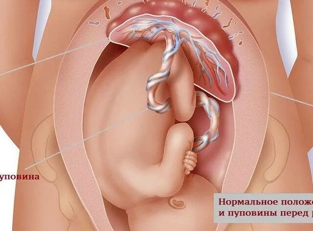 40 неделя беременности шевелится. Болит желудок 40 неделя беременности. Сильные шевеления в матке. Пуповина после 40 недели.