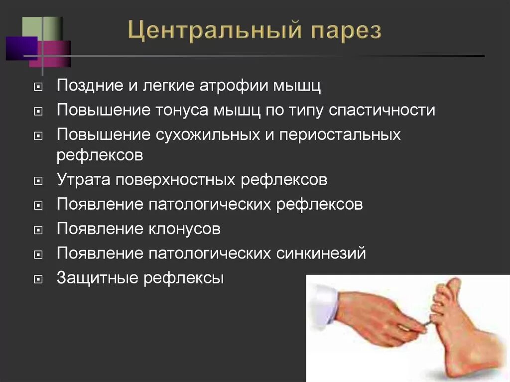 Периферические парезы конечностей. Признаки центрального пареза. Центральный парез симптомы.