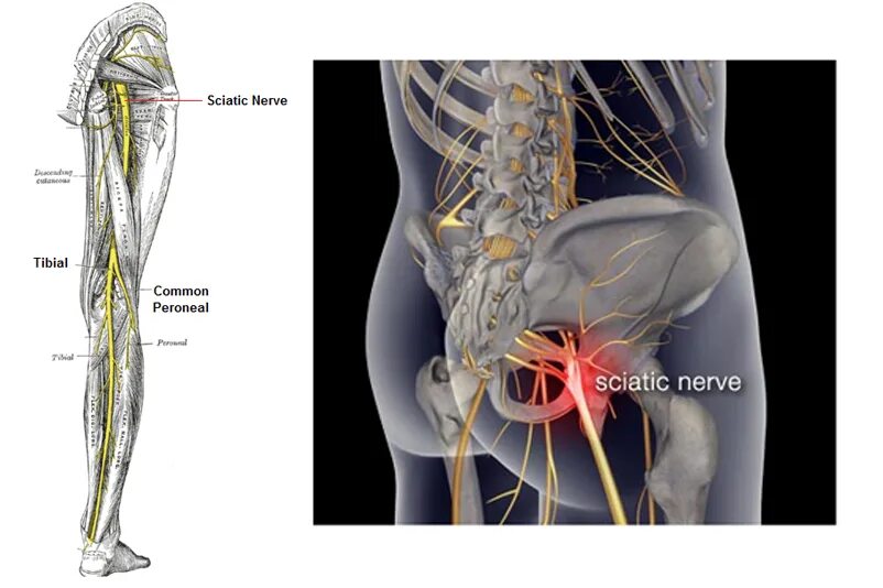 Седалищный нерв анатомия схема. Седалищный нерв (sciatic nerve)? 011. Седалищный нерв анатомия топография. Мышцы ягодиц анатомия седалищный нерв. Седалищный нерв правая ягодица