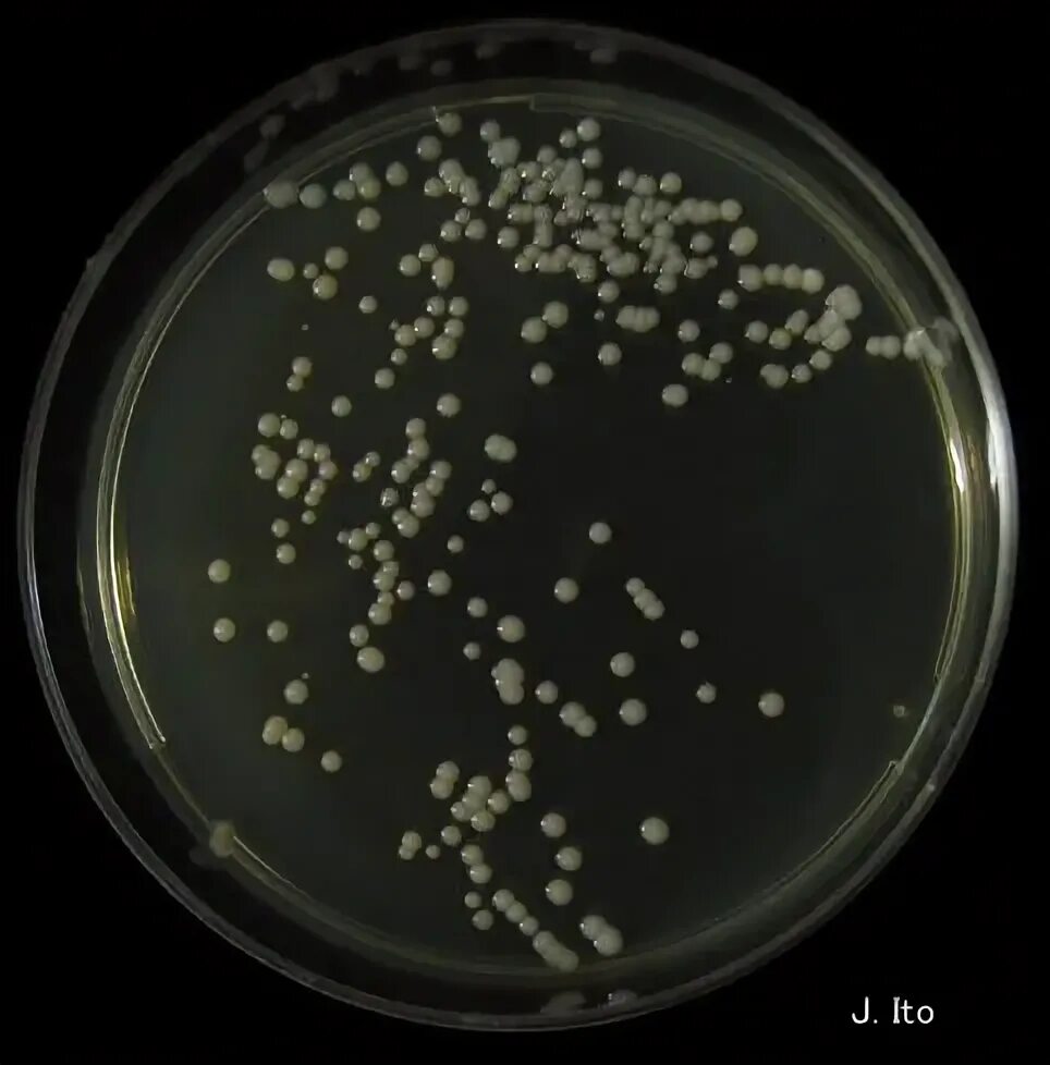 Дрожжеподобные грибы candida. Дрожжеподобные грибы рода Candida. Кандида тропикалис. Псевдомицелий это микробиология.