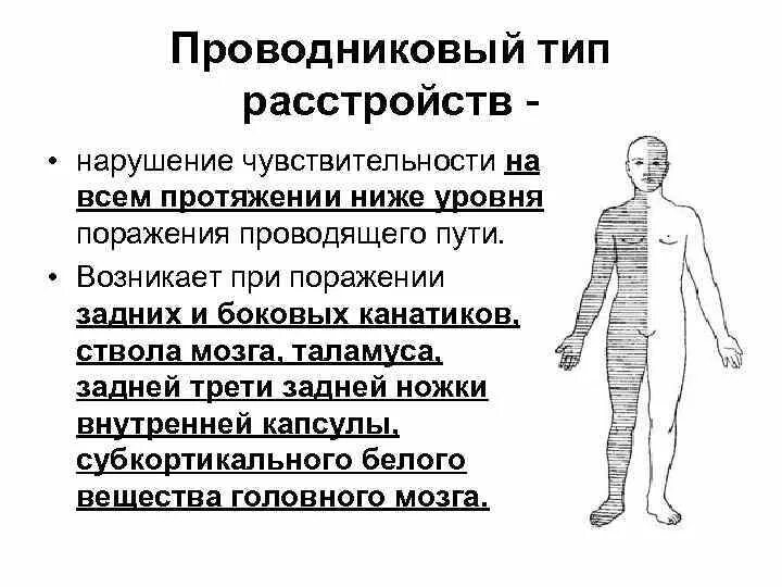 Типы поражения чувствительности. Невральный Тип расстройства чувствительности. Тип расстройства чувствительности Невра. Типы расстройств чувствительности неврология. Проводниковый Тип чувствительных расстройств.