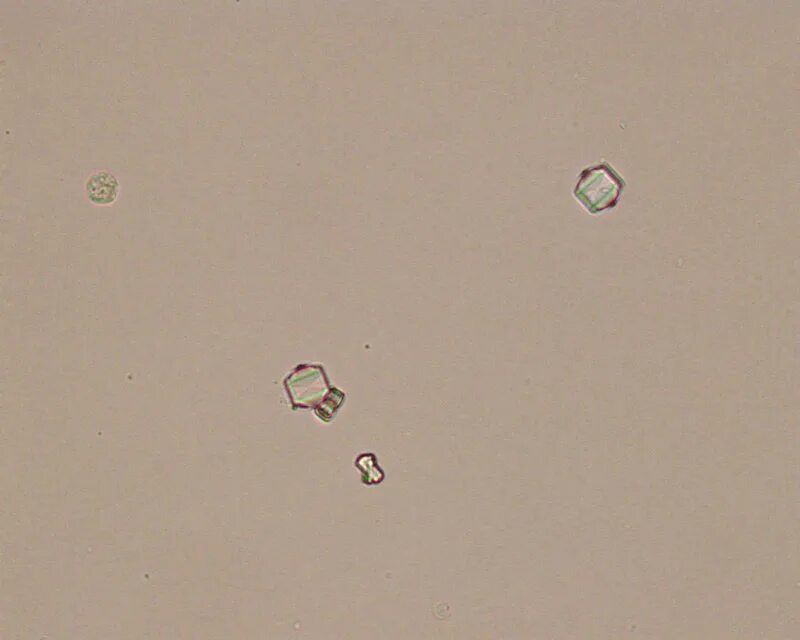 Кристаллы оксалата в моче у мужчин. Оксалаты рыбы. Оксалаты в моче. Оксалат розовый. Оксалаты в моче под микроскопом.