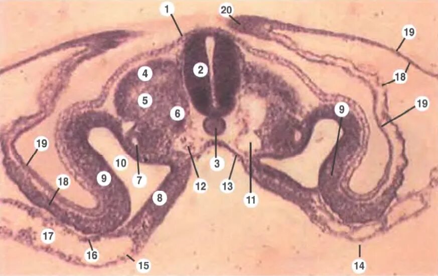 Туловищная и амниотическая складки зародыша курицы. Туловищная и амниотическая складки зародыша курицы гистология. Зародыш курицы на стадии образования туловищных складок. Препарат туловищная и амниотическая складка.