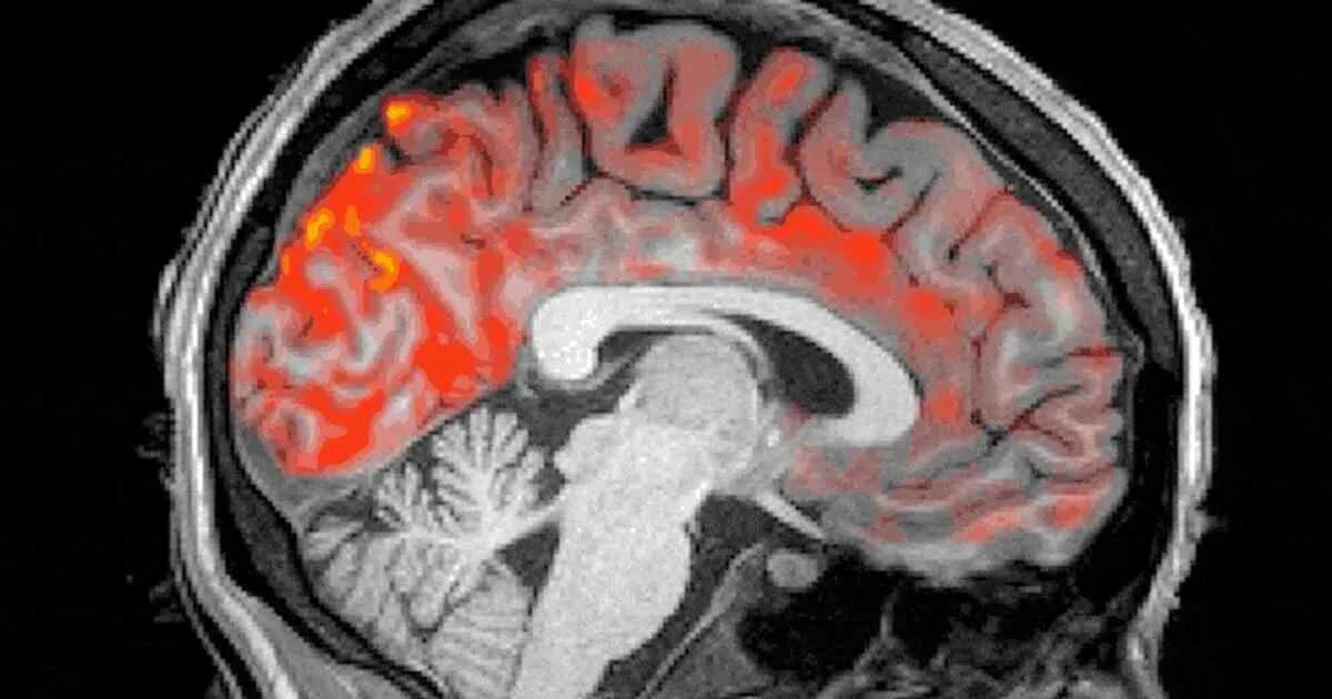 Sleeping brains. Сон мозг мрт. Мозг во время сна. Мозг инженера на мрт прикол. Мозги из мусорки.