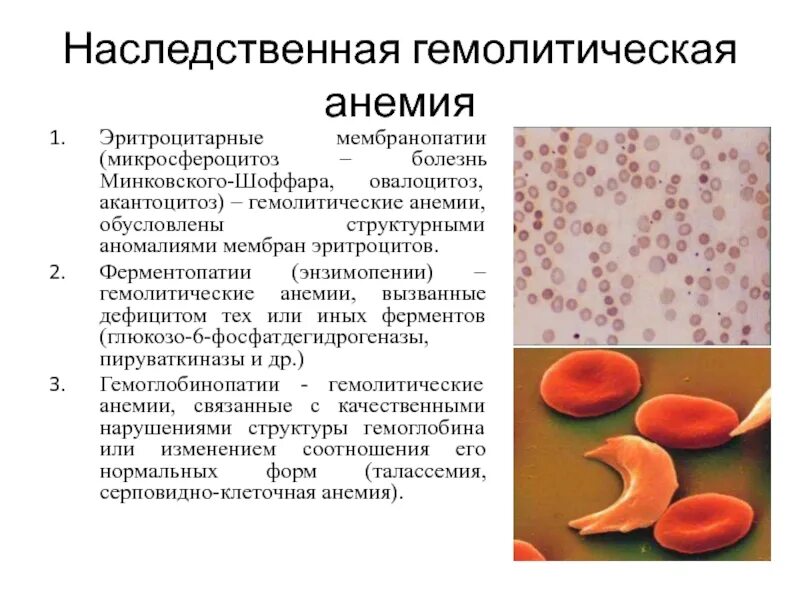 Дефекты эритроцитов
