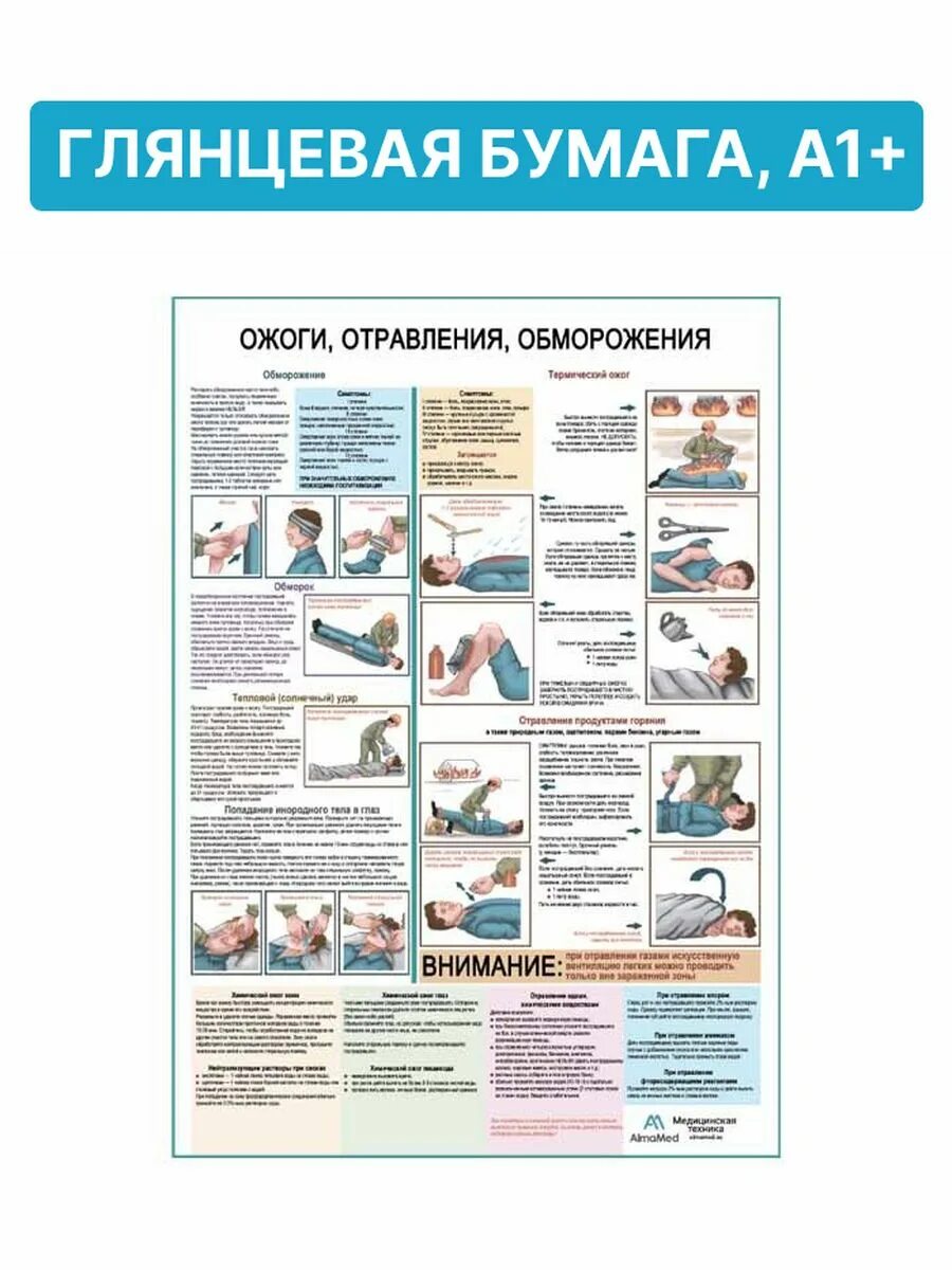 Доврачебная помощь при ожогах обморожениях