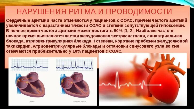 Нарушение автоматизма сердца. Экг при нарушении сердечного ритма и проводимости. Сердечные нарушения. Нарушение ритма. Изменение ритма сердцебиения.