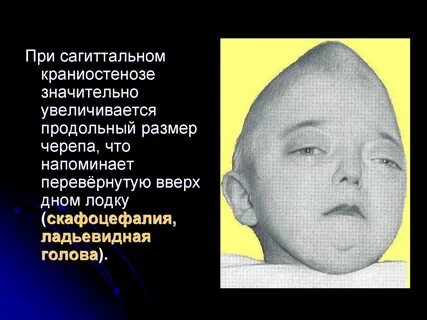 С диагнозом черепно