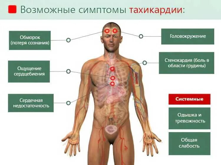 Почему сильно бьется сердце и трясет. Тахикардия симптомы. приступы учащенного сердцебиения. симптомы при тахикардии. учащенное сердцебиение симптомы.