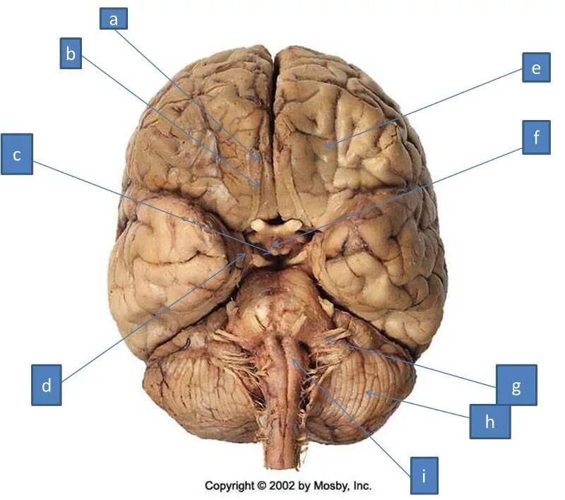Головной мозг варолиев мост. Варолиев мост строение анатомия. Мозжечок и продолговатый мозг анатомия. Задний мозг варолиев мост.