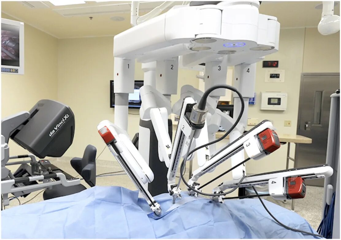 Хирургический робот DAVINCI. Роботизированная система да Винчи. Робот-хирург da Vinci (да Винчи). Робот-ассистированная хирургическая система «da Vinci».