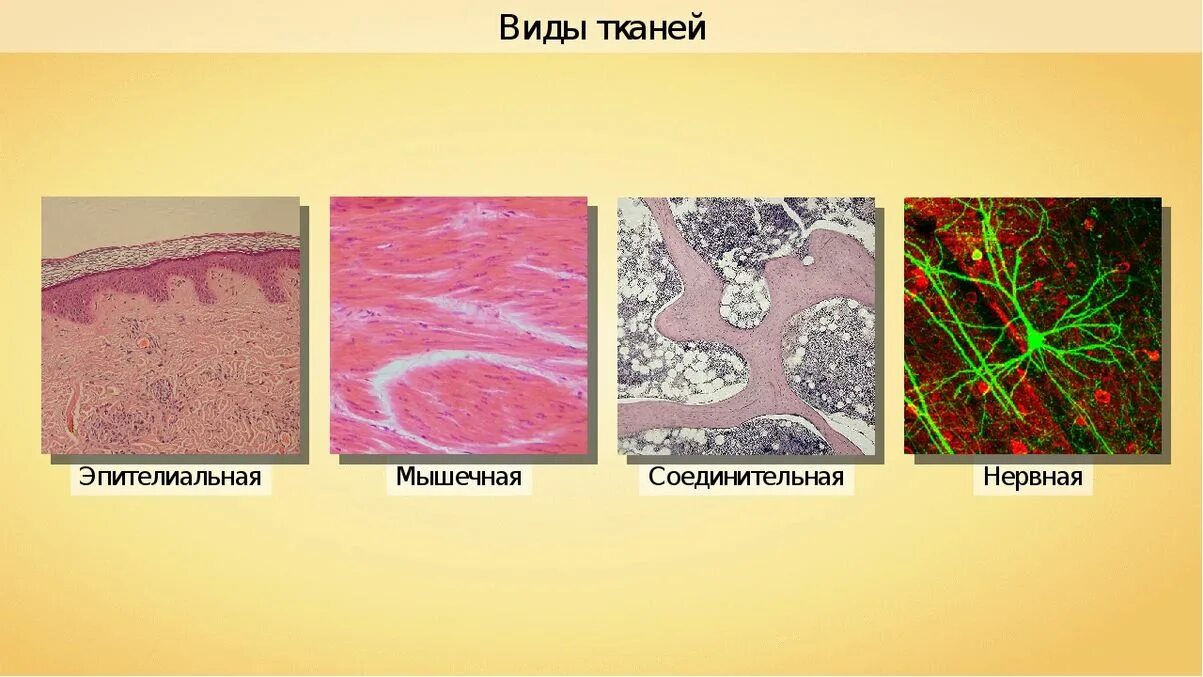 Названия тканей человека. Мышечная соединительная ткань. Ткани эпителиальная соединительная мышечная нервная. Ткани эпителиальная соединительная мышечная нервная рисунки.