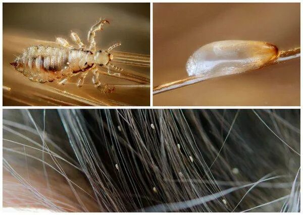 Как выглядит личинка вша. Имаго вши. Головная вошь (pediculus humanus capitis). Как выглядит личинка вша. Платяная вошь отряд.