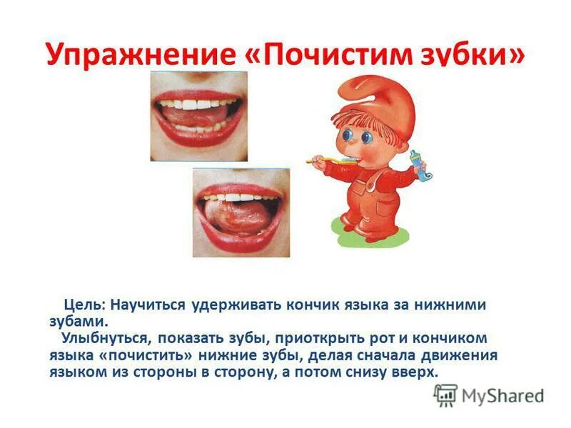 Упражнение почистим зубы артикуляционная гимнастика. Аритикуляционная гимнастика общий ком. Чистим зубки логопедическое упражнение. Чистим верхние зубки артикуляционная гимнастика. Артикуляционная гимнастика для постановки звука ш.