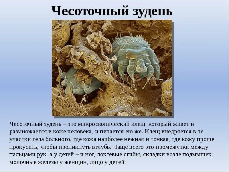 К классу паукообразных относится чесоточный клещ. Чесоточный зудень класс. чесоточный клещ класс паукообразные. биология 7 класс чесоточный клещ. чесоточный зудень паукообразные.