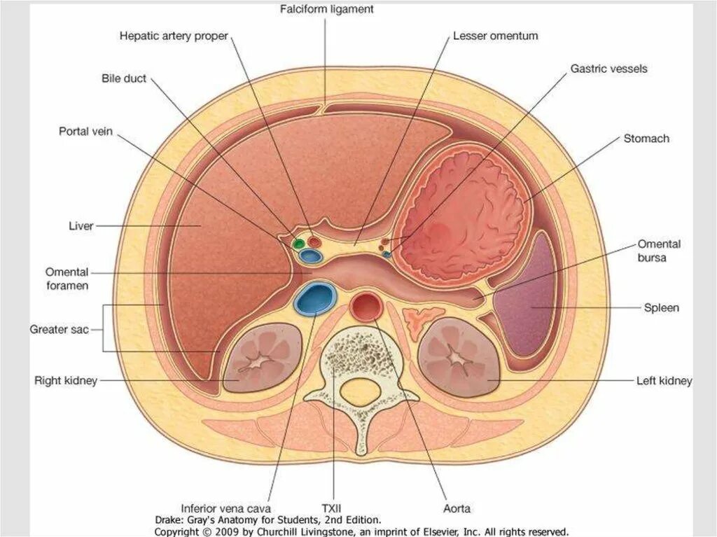 Поперечный разрез сальниковой сумки. Сальниковая сумка поперечный срез. Поперечный распил забрюшинного пространства схема. Сальниковая сумка кт анатомия. Отверстие в печени