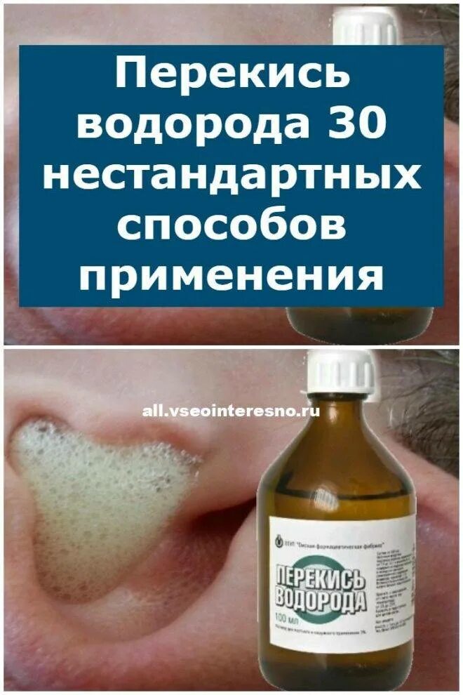 Перекись водорода от морщин. Тоник для лица в оранжевой упаковке. Перекись водорода. Перекись водорода. Хлоргексидин и перекись водорода одно и тоже или нет сравнить.