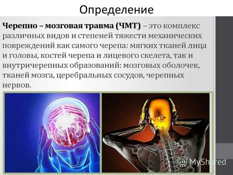 черепно-мозговая травма (чмт). сеоепно мозгоапя травиа. черепно мозговые травмы реферат. пмп при черепно-мозговой травме. чмт механизм возникновения.