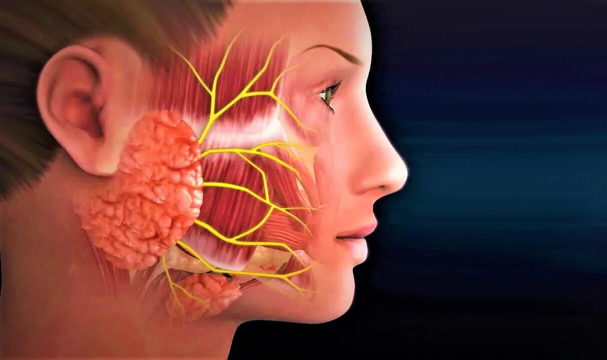 Опухоль околоушной слюнной железы. Шишка в околоушной слюнной железы. Онкология околоушная слюнная железа. Околоушная слюнная железа 3д. Околоушная железа нерв