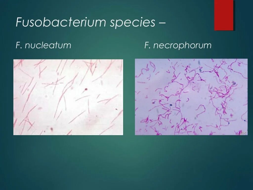 Fusobacterium spp. Фузобактерии нуклеатум. фузобактерии питательные среды. фузобактерии таксономия микробиология. fusobacterium spp микроскопия.