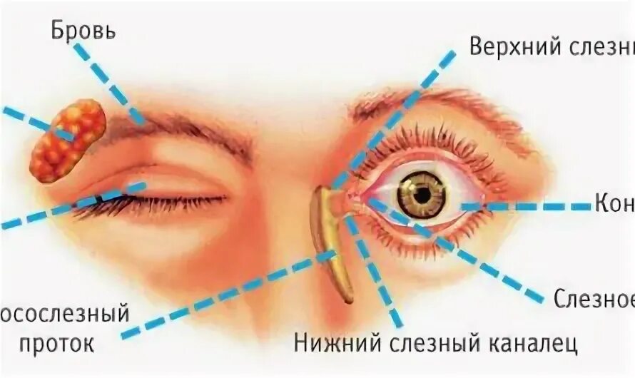 Конъюнктивальный мешок где фото. Дакриоцистит нижнего века. нижний конъюнктивальный мешок где находится. конъюнктивальный мешок куда капать фото. ячмень и воспаление слезного канала разница.