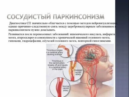 Сосудистый диагноз